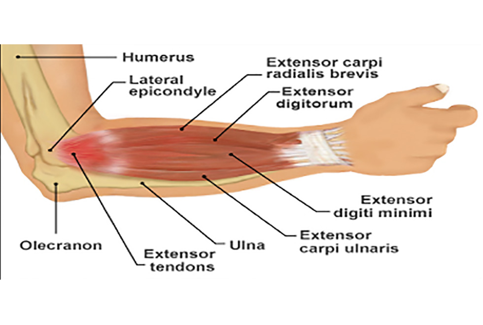 BIOMECHANICS-Figure1a